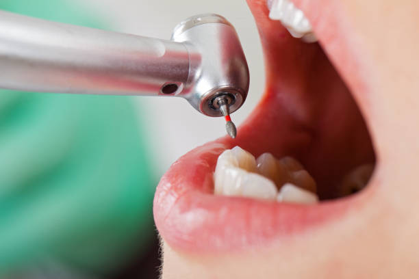 Best Weekend Emergency Dentist in Greenville, VA